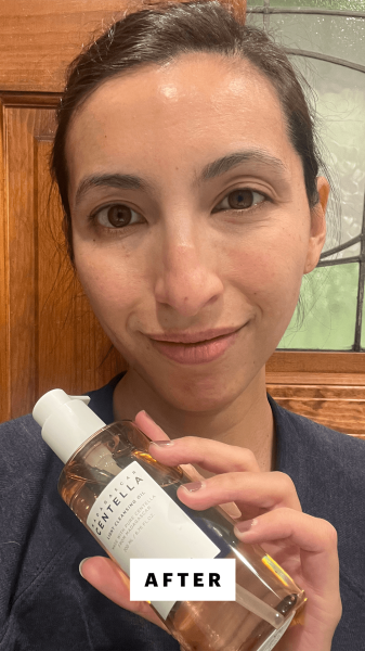 Pai after applying the Skin1004 Madagascar Centella Light Cleansing Oil